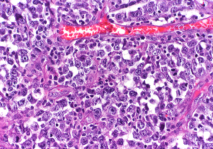 Ascentage Pharma B-Cell Cancer Candidate Receives FDA IND Clearance